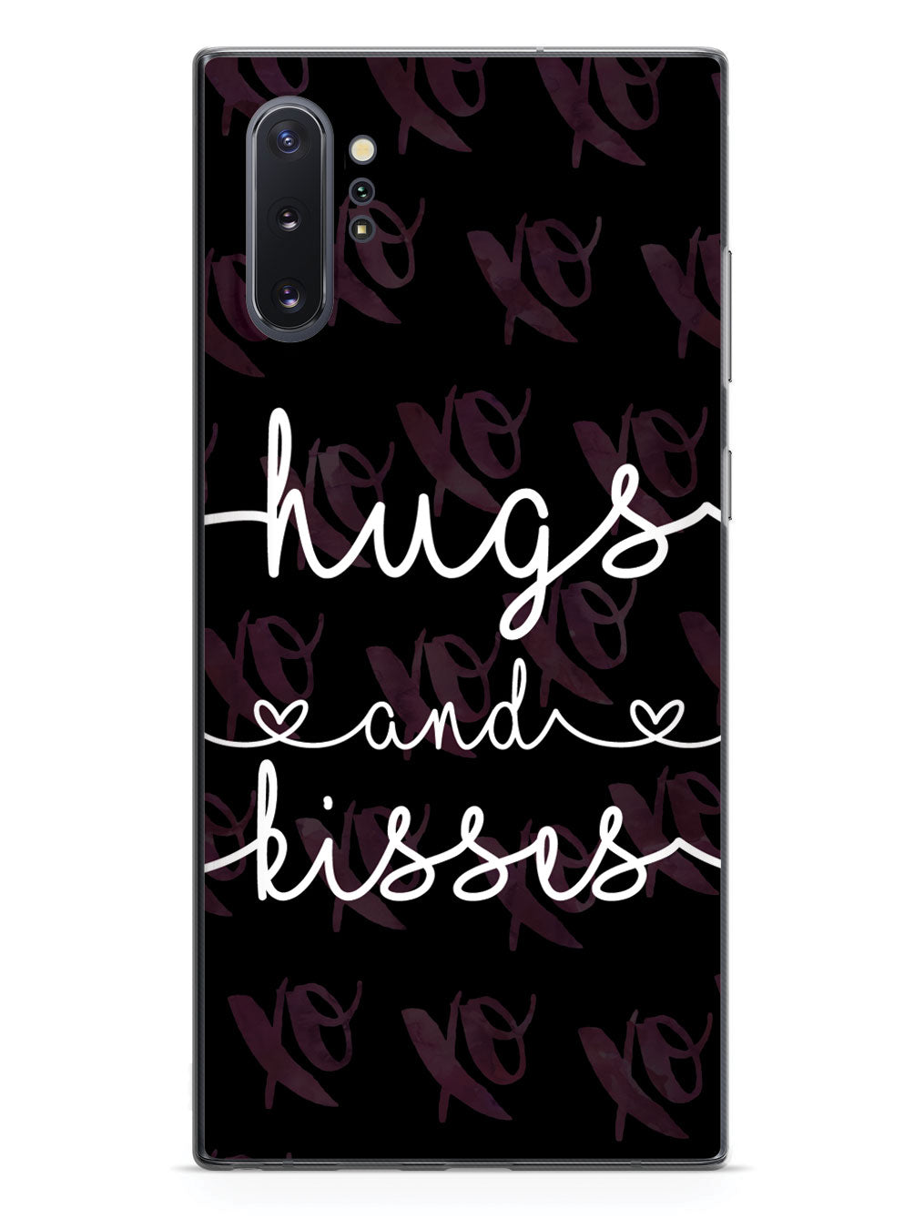 Hugs and Kisses Case