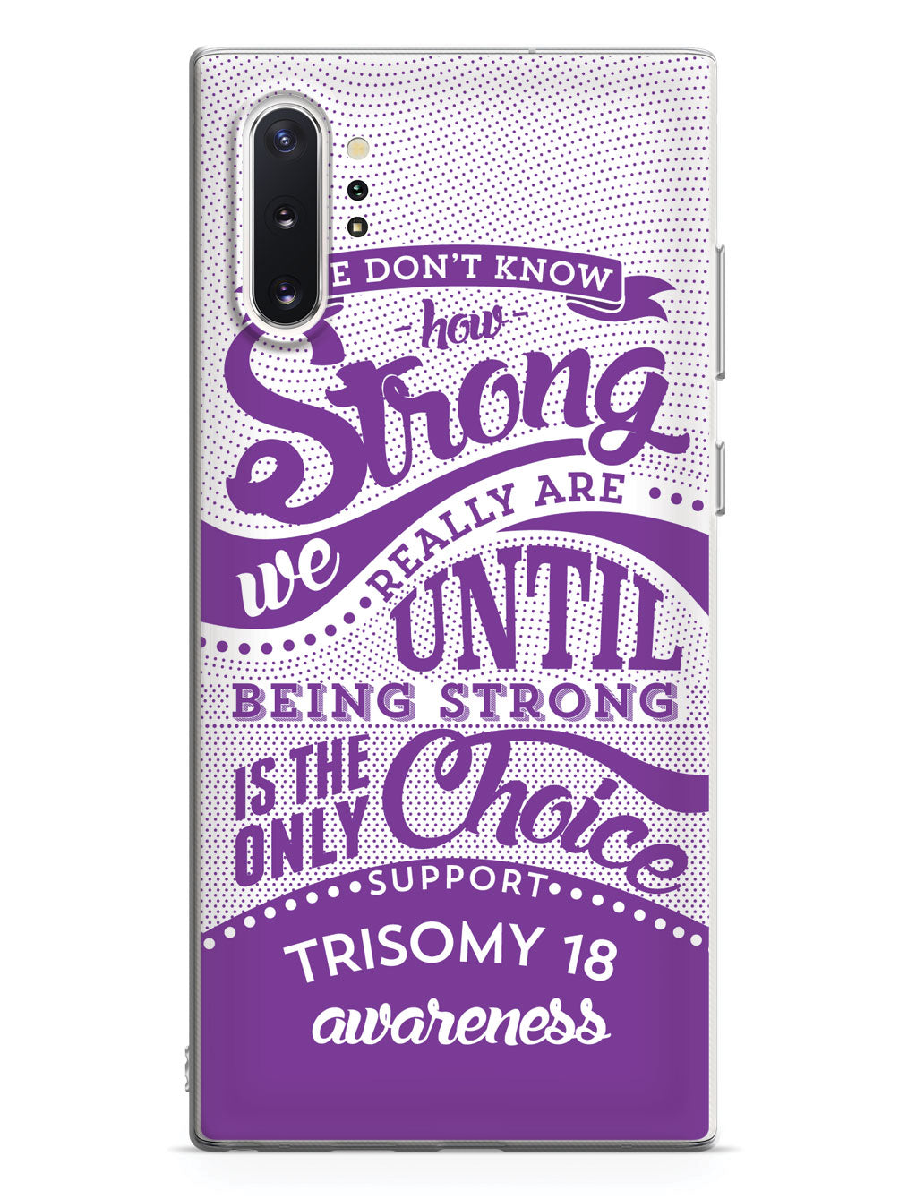 Trisomy 18 - How Strong Case