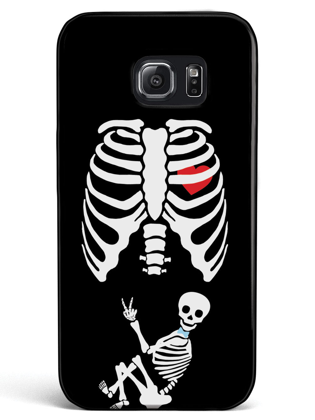 Expecting Skeleton Mom - Boy Case