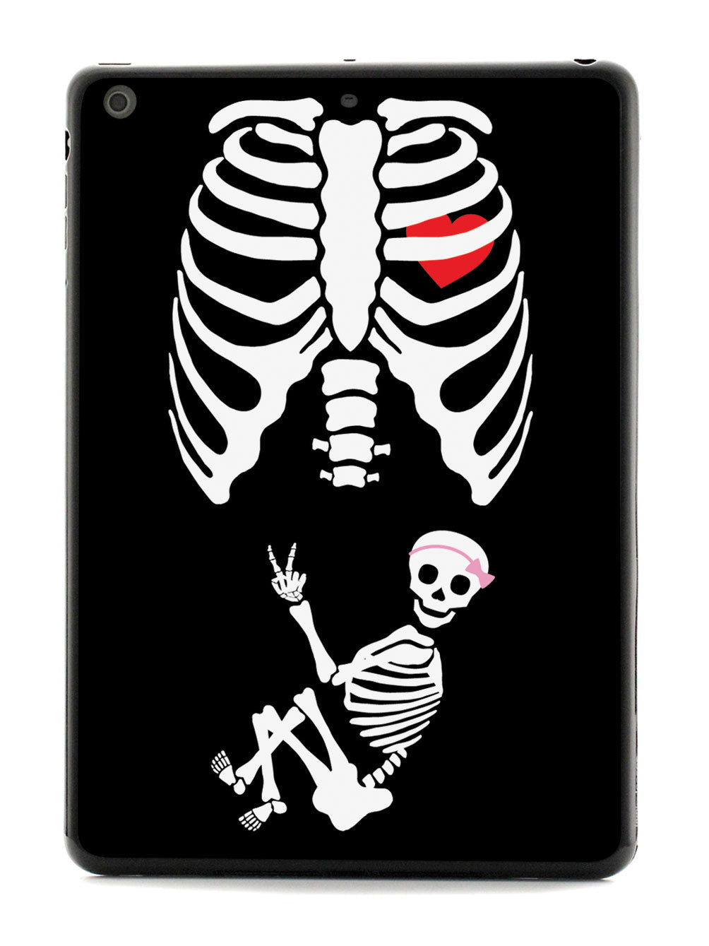 Expecting Skeleton Mom - Girl Case