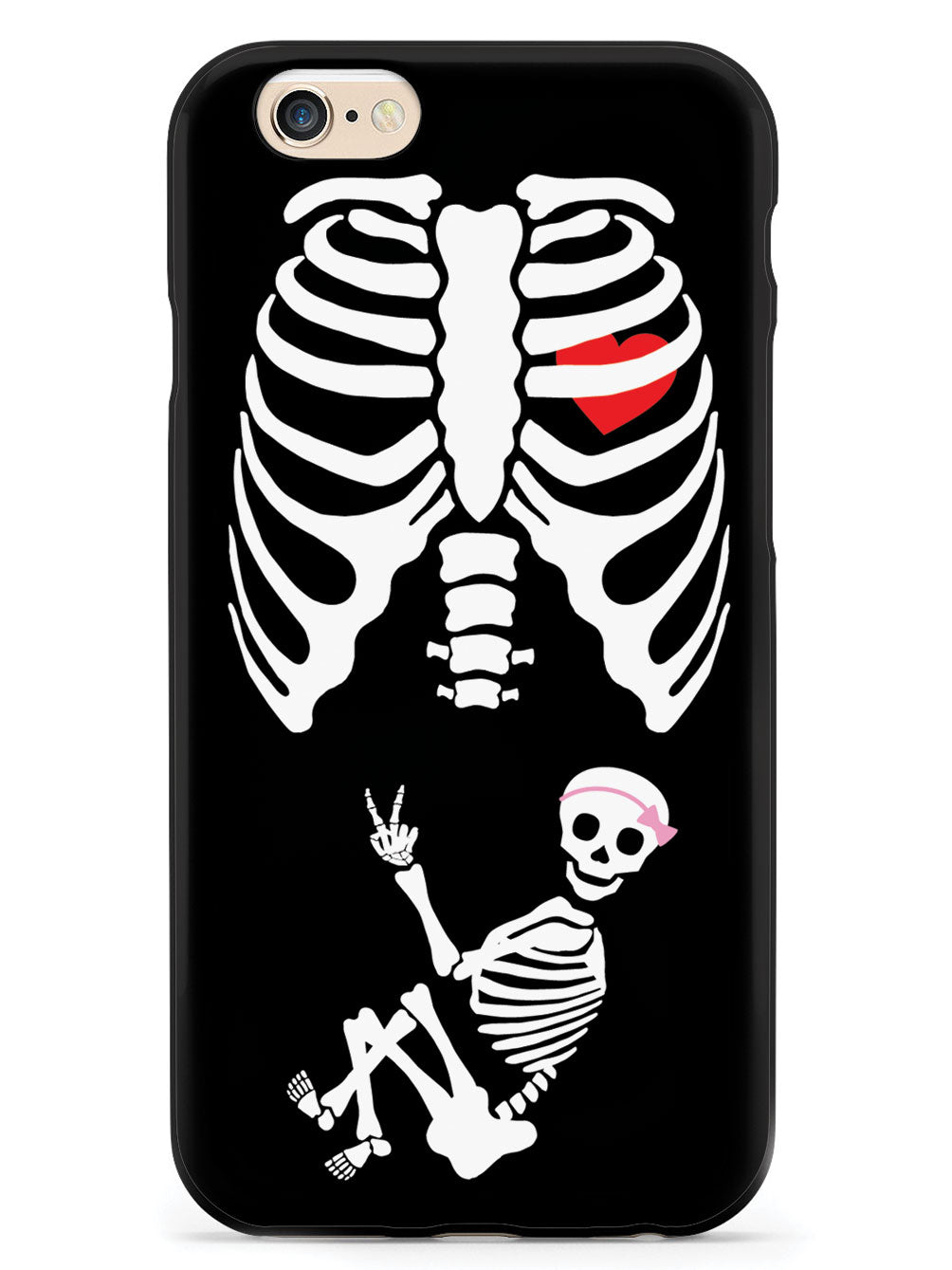 Expecting Skeleton Mom - Girl Case