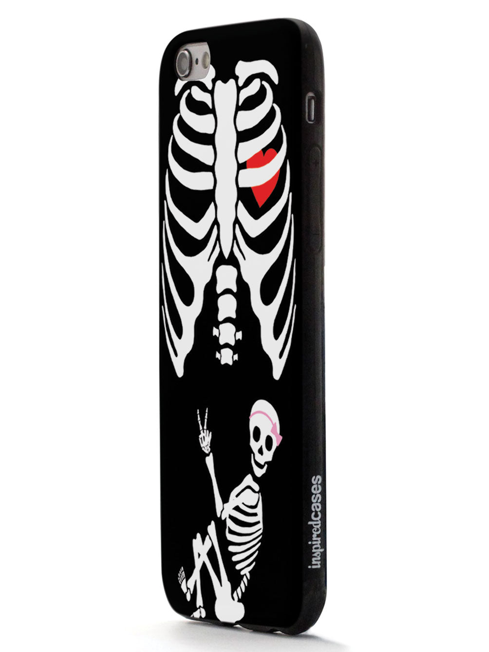 Expecting Skeleton Mom - Girl Case